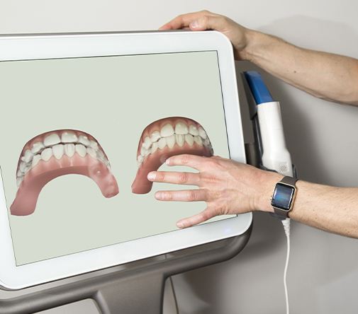 digital teeth on computer screen