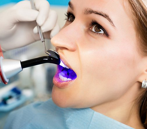 Dentist applying UV light to harden a patient’s dental bonding