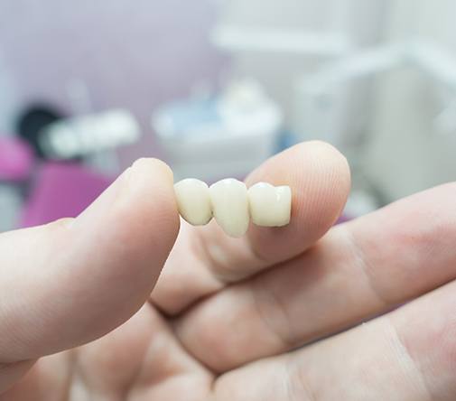 Dentist holding a dental bridge