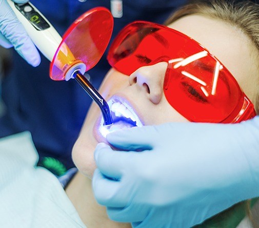 woman having direct bonding done wearing protective glasses