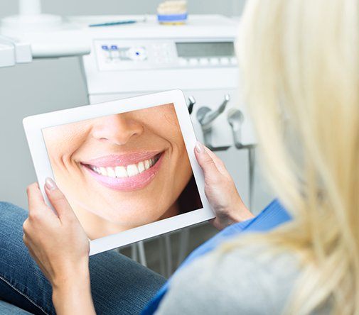 virtual smile design on tablet