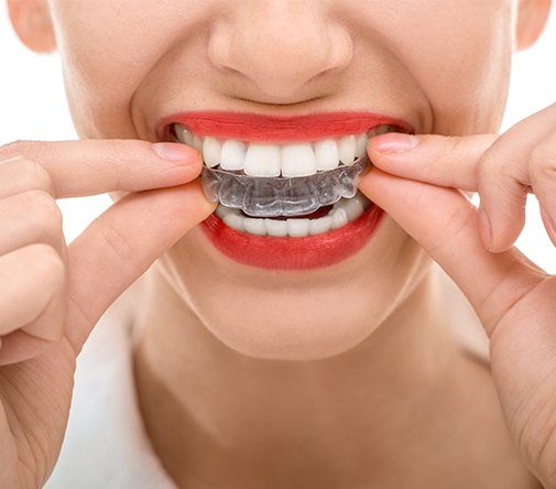 woman wearing red lipstick putting in invisalign