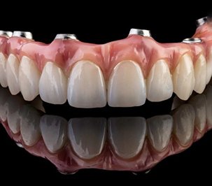 Implant dentures resting on reflective surface