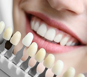 A dentist using a shade guide to assess a patient’s smile