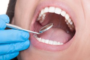 Dentist in Marysville looks for oral cancer