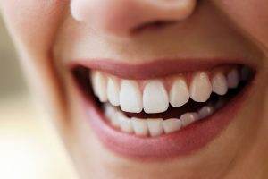 Your dentist in Marysville offers fluoride varnish for a healthy smile.