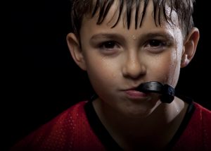 A custom mouthguard from your dentist in Marysville protects your teeth from hard hits to the mouth.