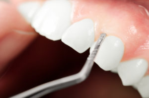 Closeup of gums without gum disease