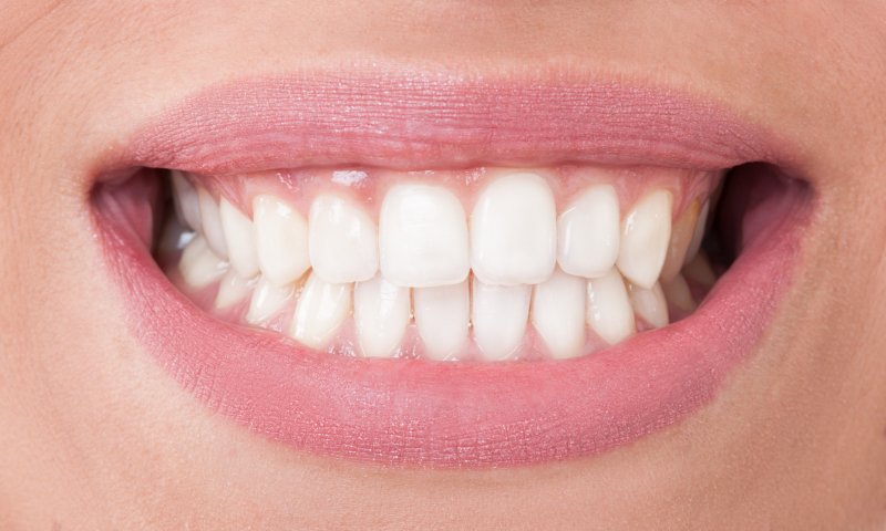 full set of teeth