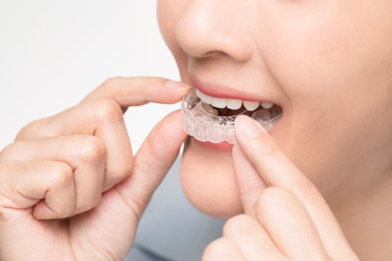 woman taking out an aligner